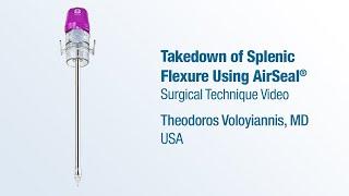 Dr. Theodoros Voloyiannis - Takedown of Splenic Flexure Using AirSeal® - CONMED Surgical Technique