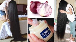 How to use Vaseline and onion to grow hair 2 cm per day Very fast 