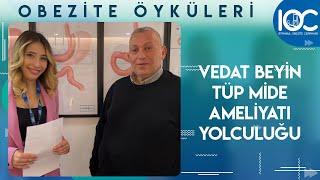 Vedat Beyin Tüp Mide Ameliyatı Yolculuğu  İstanbul Obezite Cerrahisi