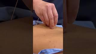 ASMR Relaxing Chinese Tuina Massage and Acupuncture #shorts