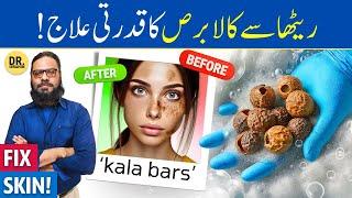 Reetha Ke FaydeIstemal  Soap Nuts Soapberry Benefits  Kala Bars  Dr. Ibrahim