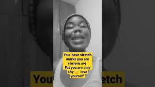 if you have stretch marks dont be shy love yourself