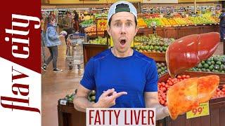 Top 10 Foods For Reversing FATTY LIVER DISEASE...And What To Avoid