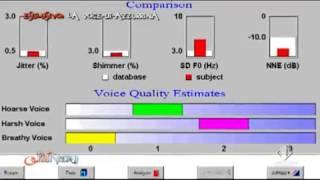 Mistero La voce di Azzurrina