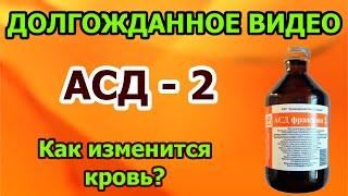 Кровь после АСД 2