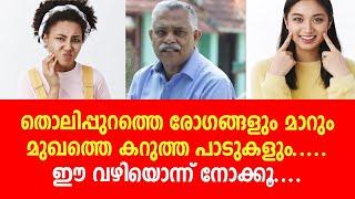 തൊലിപ്പുറത്തെ രോഗങ്ങളും മാറുംമുഖത്തെ കറുത്ത പാടുകളും...ഈ വഴിയൊന്ന് നോക്കൂ....