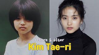 Kim Tae-ri before and after