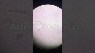 Semen Wash For IUI  Sperm Wash  Intrauterine Insemination #iui #semenwash #semen