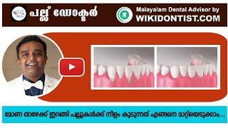 മോണ താഴേക്ക് ഇറങ്ങി പല്ലുകൾക്ക് നീളം കൂടുന്നത് എങ്ങനെ മാറ്റിയെടുക്കാം... gum recession dental