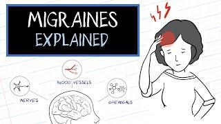 What are Migraines? HealthSketch