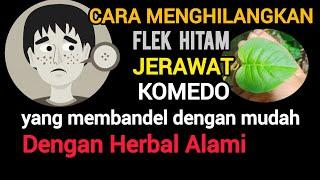 penghilang flek hitam jerawat komedo di wajah paling ampuh buktikan  cara alami