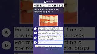 NEET MDS  INI-CET MDS  PSC  BDS - Most Important Questions  #neetmds2025 #mdsprep