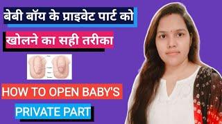 How To Open Baby Boy Private Part बेबी बॉय का सुसु कैसे खोले बेबी बॉय का प्राइवेट पार्ट कैसे खोलें