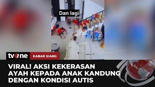 Pilu Anak Berkebutuhan Khusus di Surabaya 8 Tahun Dianiaya Ayah  Kabar Siang tvOne