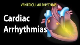 Cardiac Arrhythmias Animation