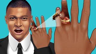 ASMR Help Kylian Mbappé remove his ring that was stuck due to swelling in his hand from a bee sting