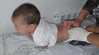 Injection Into The Babys Buttock. IM INJECTION . Внутримышечный укол детям в ягодицу