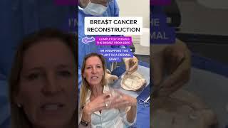 Plastic Surgeon Reacts  Using Dermal Matrix for Breast Reconstruction