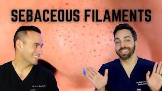 Black Dots on the Nose? Heres How To Treat Sebaceous Filaments