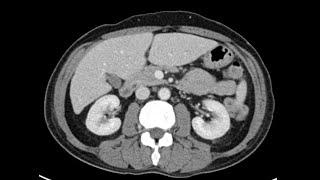 Anatomy of CT scans Abdomen