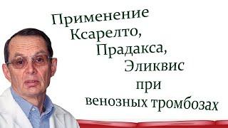 Применение антикоагулянтов при тромбозах  вен нижних конечностей. Видеобеседа для ВСЕХ и для врачей