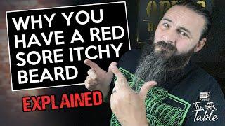 Why your skin is red itchy and sore under your beard