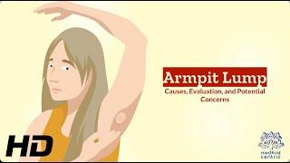 Unveiling the Mystery Understanding Armpit Lumps