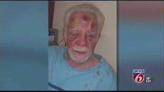 Women beat up elderly man for medicine