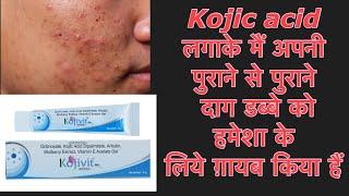 Kojic acid लगाके मैं अपनी पुराने से पुराने दाग डब्बे को हमेशा के लिये ग़ायब किय है।