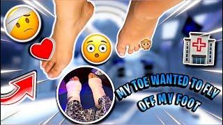 Little toe surgery Before and after -Jailyne Ojeda