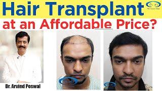 Hairtransplant in Delhi Best  Treatment  & Cost of Tranaplant in Delhi