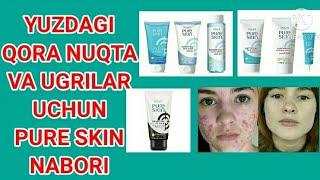 YUZDAGI UGRI VA QORA NUQTALAR UCHUN ORIFLAMEDAN PURE SKIN TO‘PLAMI