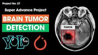 Brain Tumor Detection Using YOLOv10  Train Yolov10 object detection on a custom dataset  Mishu