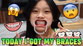 I GOT BRACES FOR THE FIRST TIME YOU WON’T BELIEVE MY TRANSFORMATION