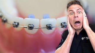 Your Orthodontist Could Be LYING To You.... Heres Why
