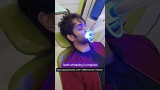 Get Amazing Teeth Whitening QUICK Dr. Srishti Bhatia