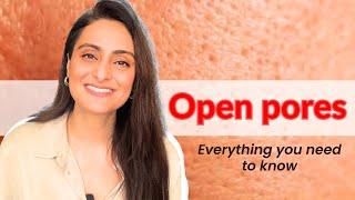 Open pores How to treat  Creams to use  Lasers   Dermatologist Dr Aanchal
