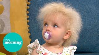 Meet The Toddler With Ultra-Rare Wild Hair Diagnosis  This Morning