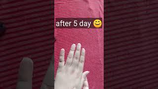 Grow Your Nails Faster  Fast nail growth #youtubeshorts #shorts #nailsgrow