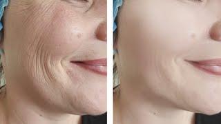 Just 1 Skin Tightening and Face lifting Home Remedy  Face Pack For Loose Facial Skin