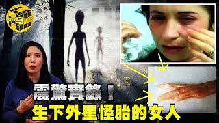 拍下了整個生育過程?！ 自稱生下了外星怪胎的女人，驚人照片與錄像背後的秘密 腦洞烏托邦  小烏  Xiaowu