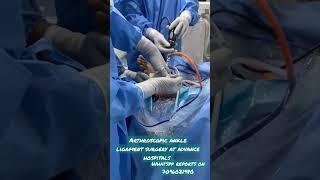 Arthroscopic ankle ligament surgery at advance hospitals .