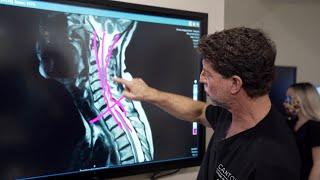 Symptoms of Cervical Stenosis  Jeffrey Cantor MD