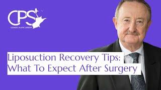 Liposuction Recovery Tips What To Expect After Surgery