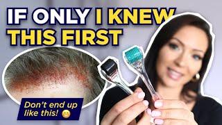 The Dermaroller Watch This BEFORE Microneedling What I wish I knew Before I Started Dermarolling