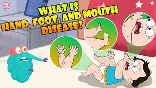 What Is Hand Foot And Mouth Disease?  Infection In Children  The Dr Binocs Show  Peekaboo Kidz