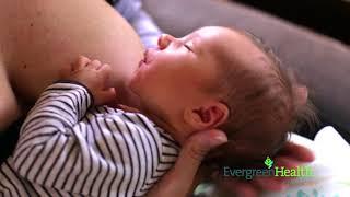 Engorgement After Giving Birth