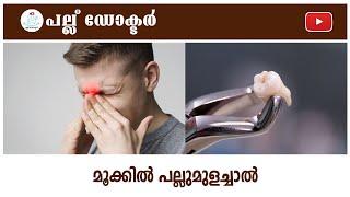 മൂക്കിൽ പല്ലുമുളച്ചാൽ  Teeth on Nose Uncovering Rare Dental Diseases