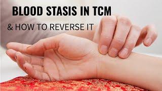 Blood Stasis in TCM and How To Reverse It