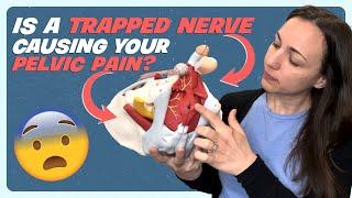 Understanding Pudendal Nerve Entrapment and Neuralgia Causes and Symptoms